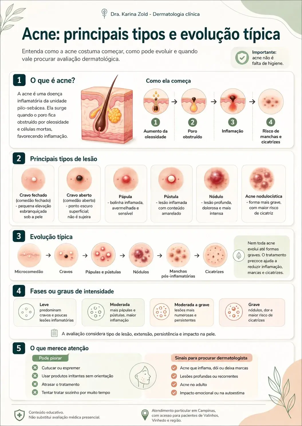 Infográfico sobre acne: tipos de lesão, evolução típica, graus de intensidade e quando procurar dermatologista — Dra. Karina Zold